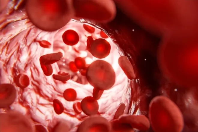 sickle cell anemia