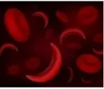 Sickle Cell Anemia