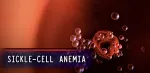 sickle cell disease 