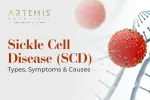 Sickle Cell Disease (SCD): Types, Symptoms & Causes
