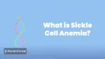 Sickle Cell Anemia