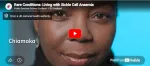 Sickle Cell Anemia