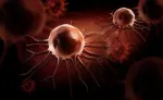 Sickle Cell Anemia