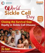 Sickle Cell Anemia