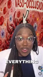 Sickle Cell Anemia