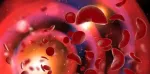 Sickle Cell Anemia