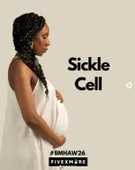 Sickle Cell Anemia