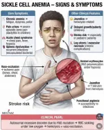 Sickle Cell Anemia