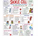 Sickle Cell Anemia
