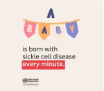 Sickle Cell Anemia