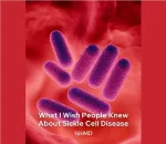 Sickle Cell Anemia