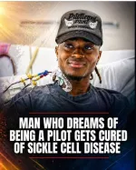 Sickle Cell Anemia