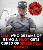 Sickle Cell Anemia
