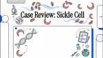 Sickle Cell Anemia