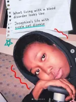 Sickle Cell Anemia