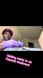 Sickle Cell Anemia