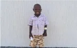 Sickle Cell Anemia