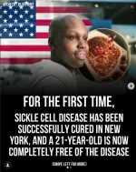 Sickle Cell Anemia