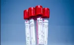 sickle cell anemia