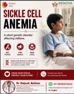 Sickle Cell Anemia