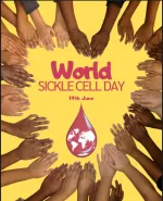 sickle cell anemia