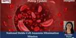 sickle cell anemia