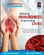 sickle cell anemia