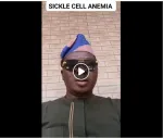 Sickle Cell Anemia