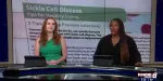 Sickle Cell Anemia