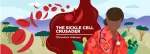 sickle cell anemia