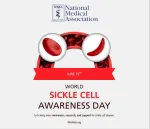 sickle cell anemia