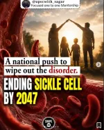 sickle cell anemia
