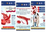 sickle cell anemia