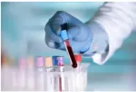 sickle cell anemia