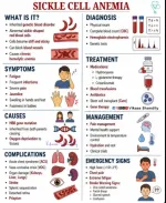 sickle cell anemia