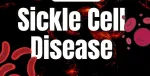 Sickle Cell Anemia