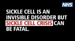 Sickle Cell Anemia
