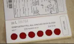 sickle cell anemia