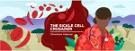 sickle cell anemia