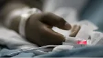 Sickle Cell Anemia