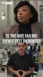 sickle cell anemia