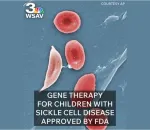 sickle cell anemia