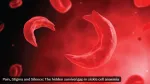 sickle cell anemia