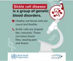 sickle cell anemia