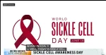 sickle cell anemia