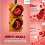 sickle cell anemia