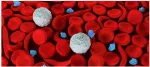 sickle cell anemia