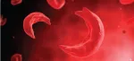 sickle cell anemia