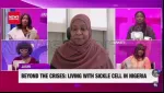 sickle cell anemia