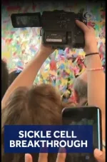 sickle cell anemia